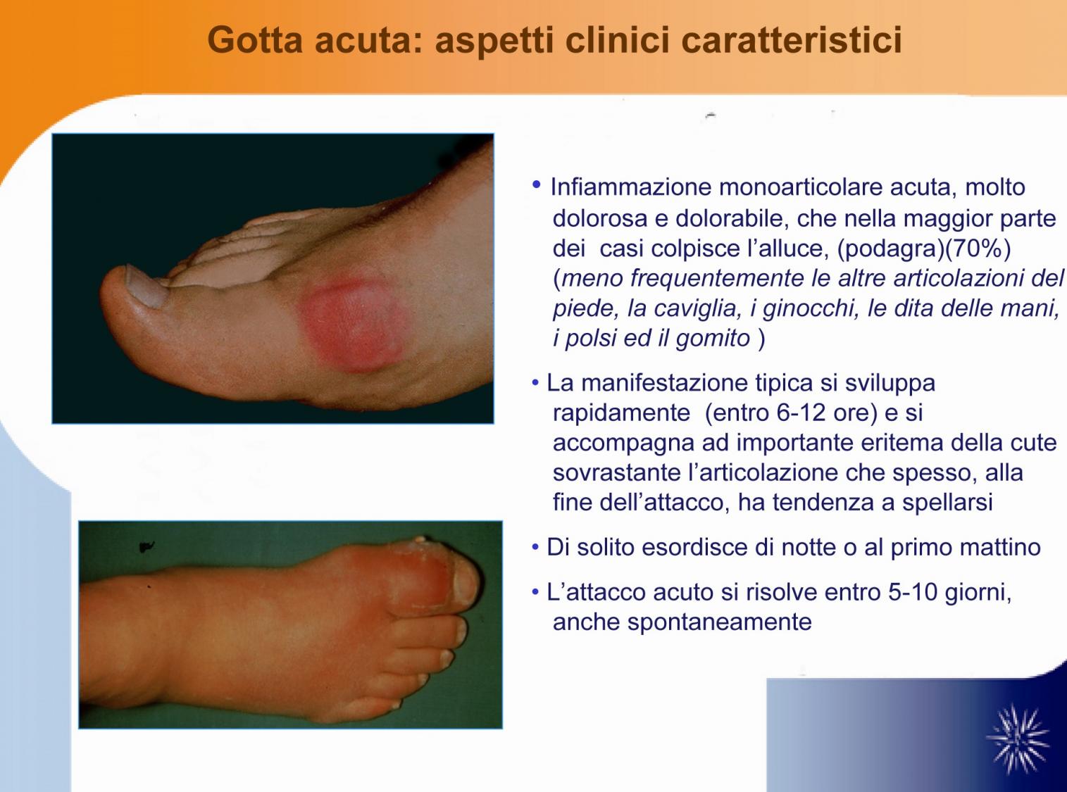 Aspetti clinici caratteristici della gotta